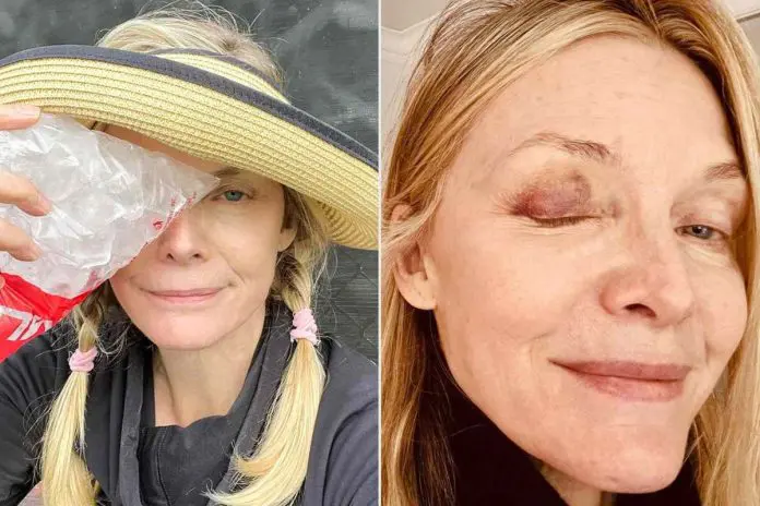 Michelle Pfeiffer's Pickleball Incident